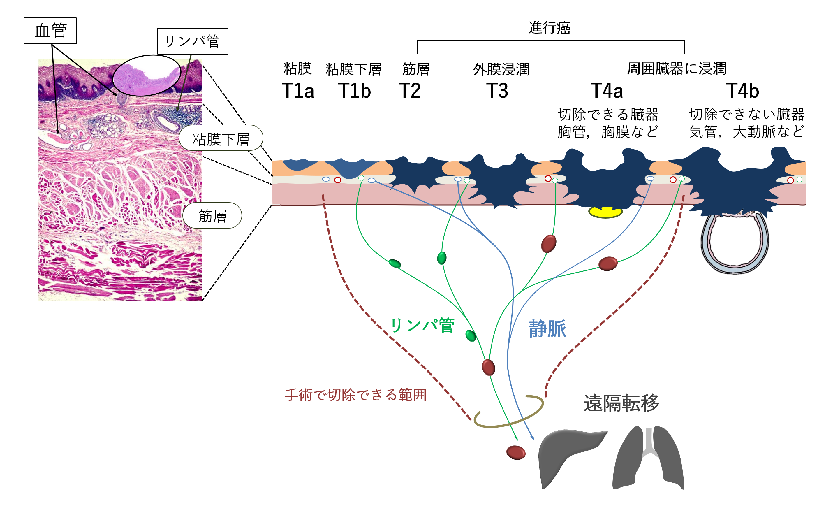 兵庫医大上部消化管外科ホームページ