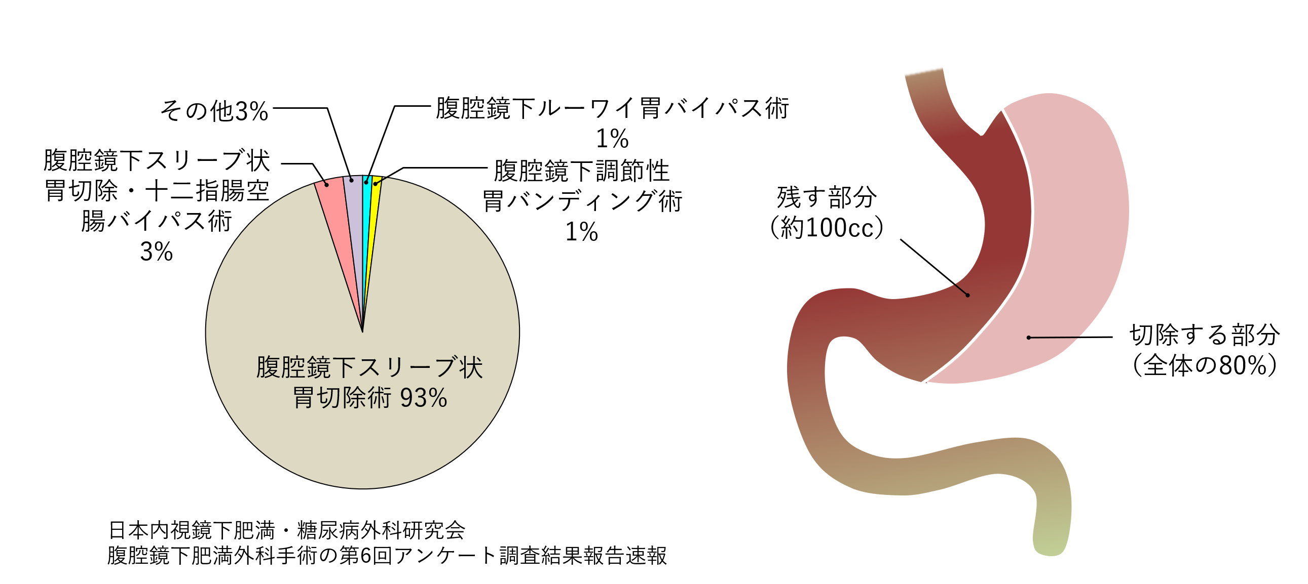 兵庫医大上部消化管外科ホームページ