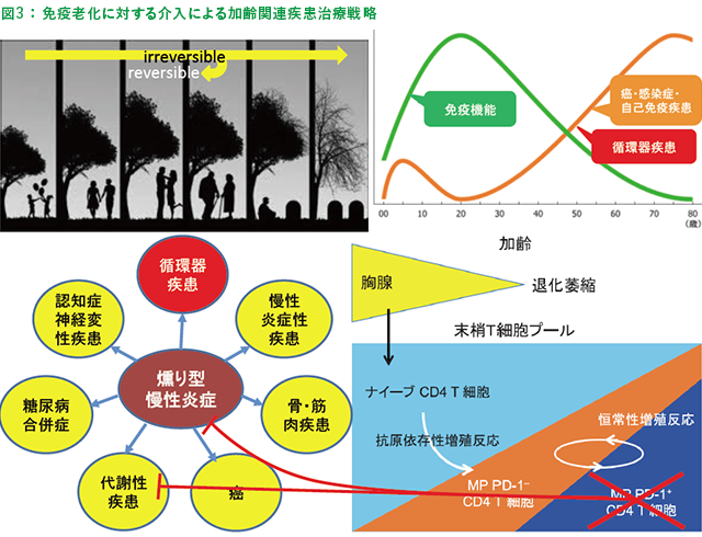 図3 ： 免疫老化に対する介入による加齢関連疾患治療戦略